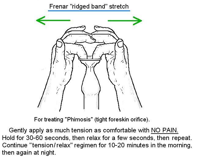 Phimosis stretching diagram